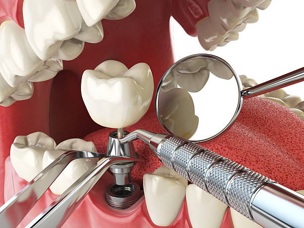 Best Broken or Cracked Tooth Emergency Dentist in Freeland, MI